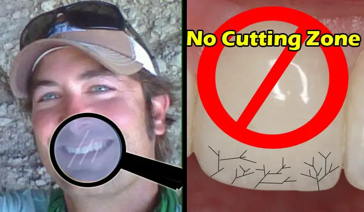 Why you should not cut fishing line with your teeth